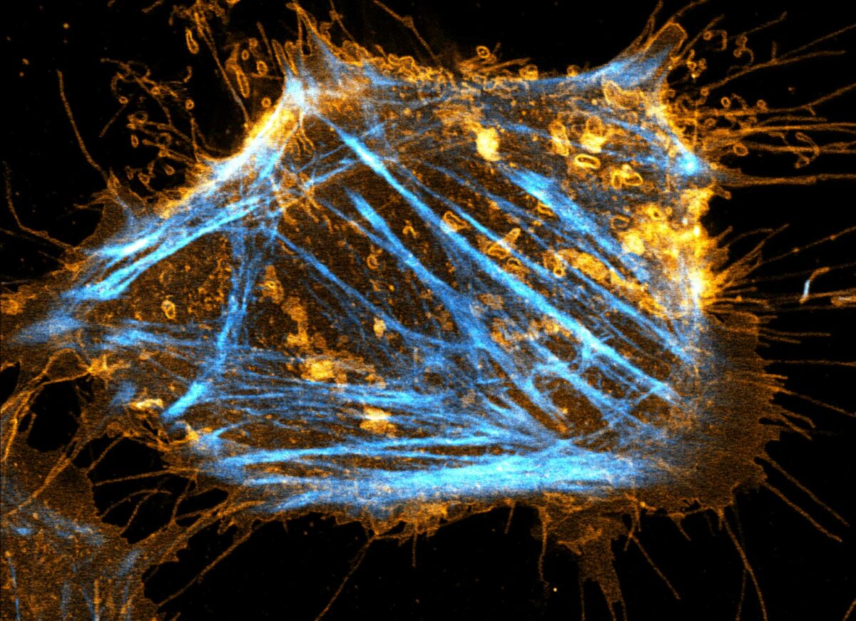 Two color live-cell STED and confocal image of a mammalian cultured cell stained with abberior STAR RED membrane (orange) and abberior LIVE 590 actin (cyan).